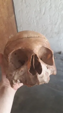Actual photo of me holding a human skull